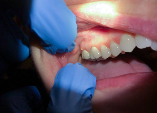 Best Emergency Dental Services for Seniors in Flomaton, AL